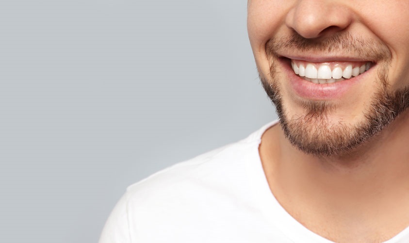 Instant orthodontics