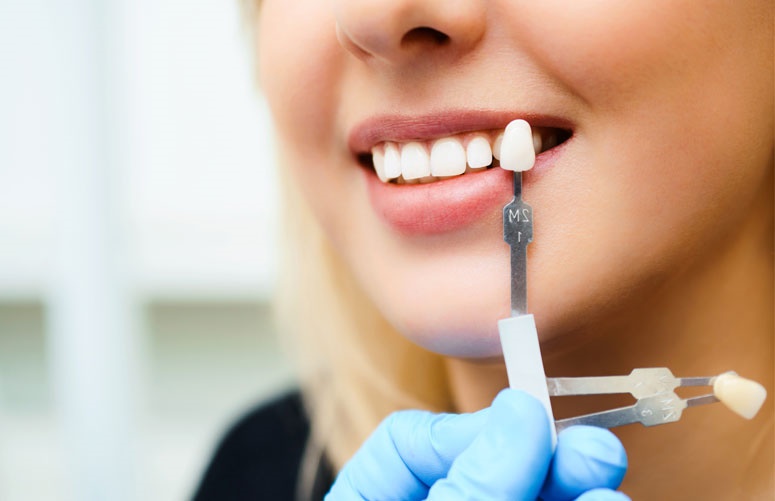 Instant orthodontics